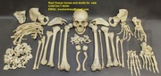 Real human skulls,  human skeletons,  and individual human bones for sal