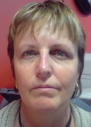 Free Event - Discover Genetic Anti-aging